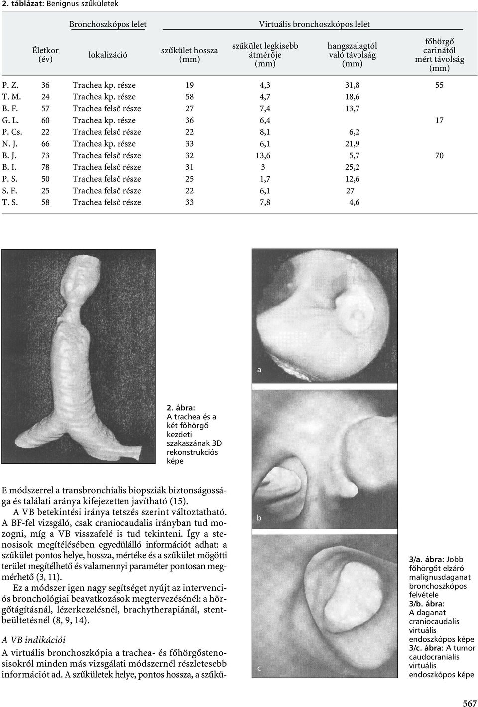 Virtuális bronchoszkópos lelet Életkor (év) lokalizáció szűkület hossza szűkület legkisebb átmérője hangszalagtól való távolság 36 24 57 60 66 73 78 50 25 58 19 58 27 36 33 32 31 25 33 4,3 4,7 7,4