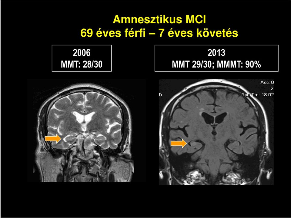 követés 2006 MMT: