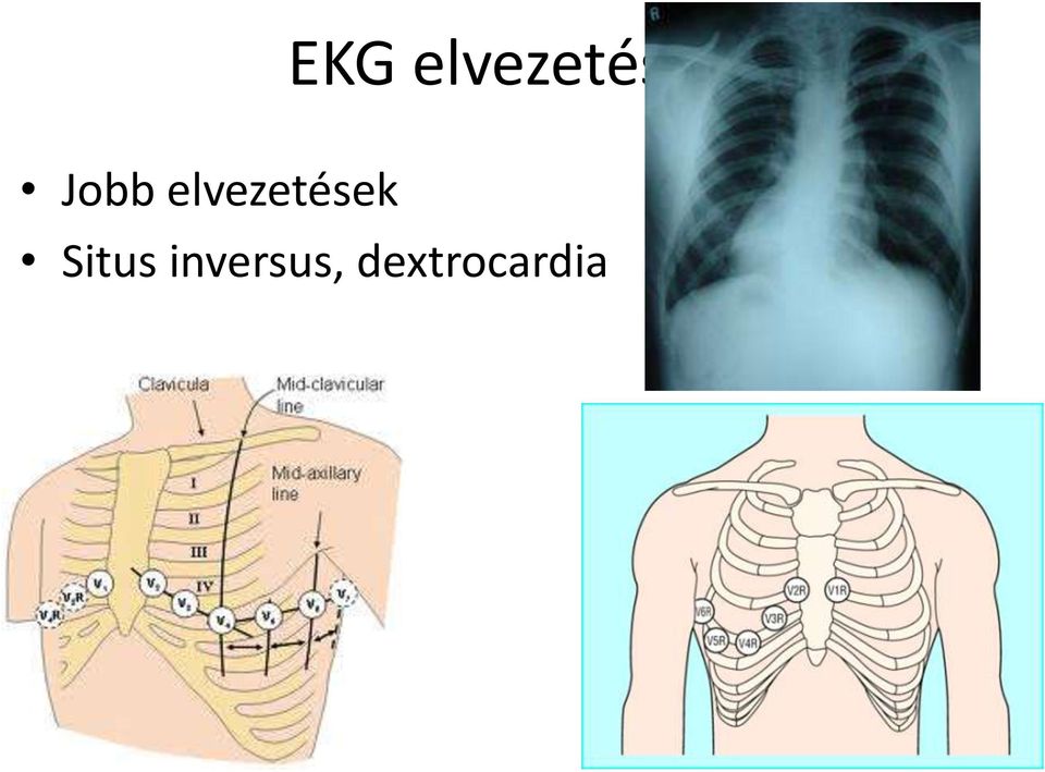 elvezetések