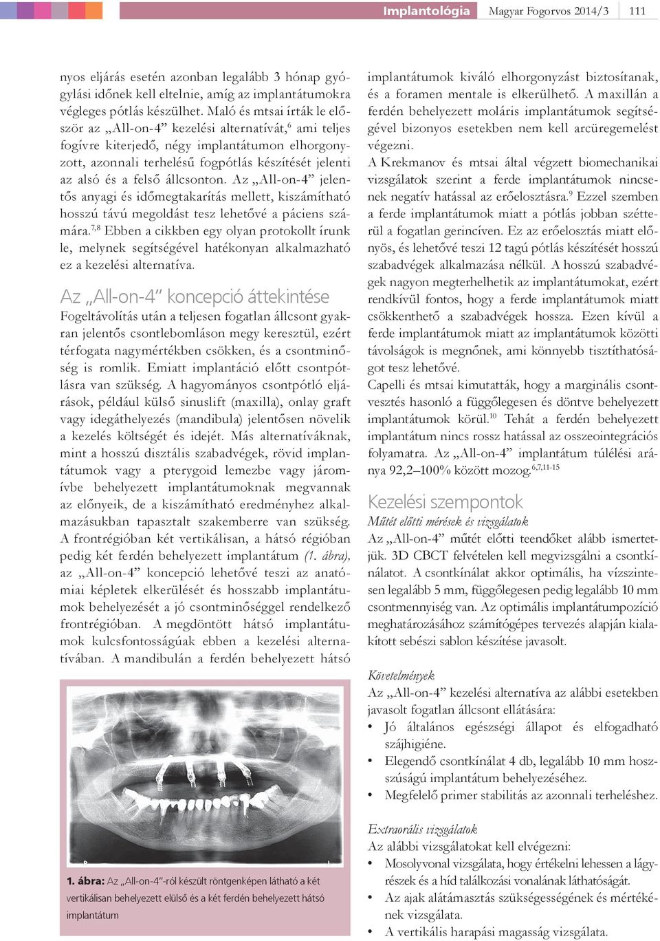 állcsonton. Az All-on-4 jelentős anyagi és időmegtakarítás mellett, kiszámítható hosszú távú megoldást tesz lehetővé a páciens számára.