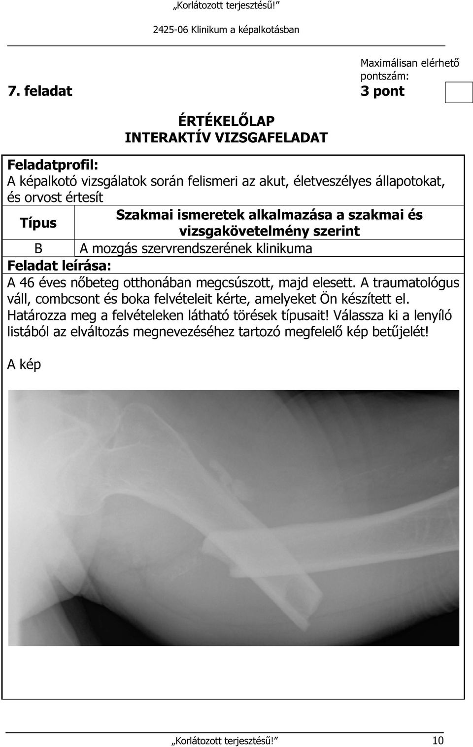 A traumatológus váll, combcsont és boka felvételeit kérte, amelyeket Ön készített el.