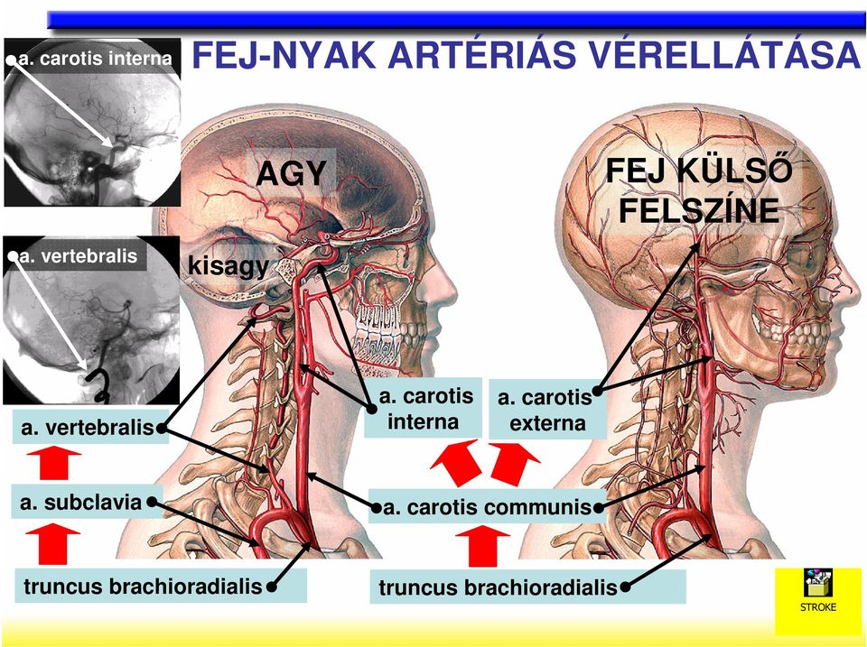 carotis interna a. carotis externa a. subclavia a.
