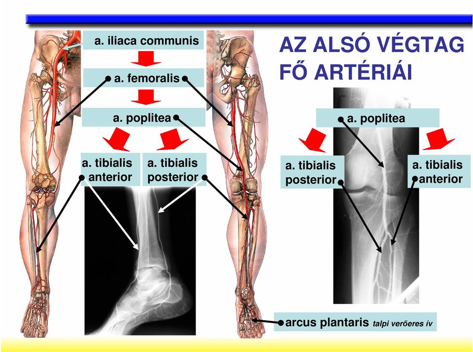 poplitea a. tibialis anterior a.