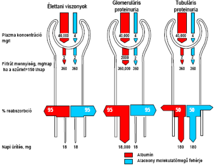 c./ Túlcsordulásos proteinuria Előfordul: Hemolíziskor- nagy mennyiségű hemoglobin filtrálódik (ha a Hgb-t megkötő haptoglobin elfogy a plazmában) Izomzúzódáskor- sok mioglobin kerül a filtrátumba