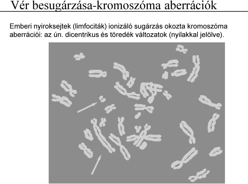 okozta kromoszóma aberrációi: az ún.