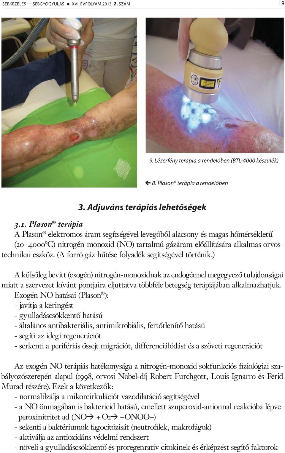 9. Lézerfény terápia a rendelőben (BTL-4000 készülék) 8. Plason terápia a rendelőben 3. Adjuváns terápiás lehetőségek 3.1.