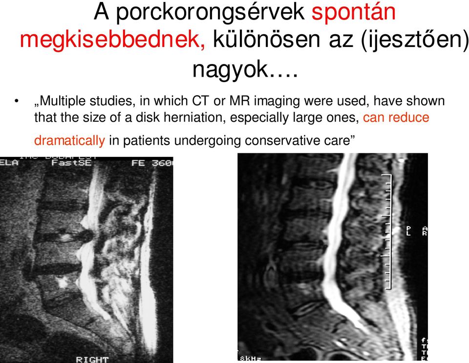 Multiple studies, in which CT or MR imaging were used, have shown