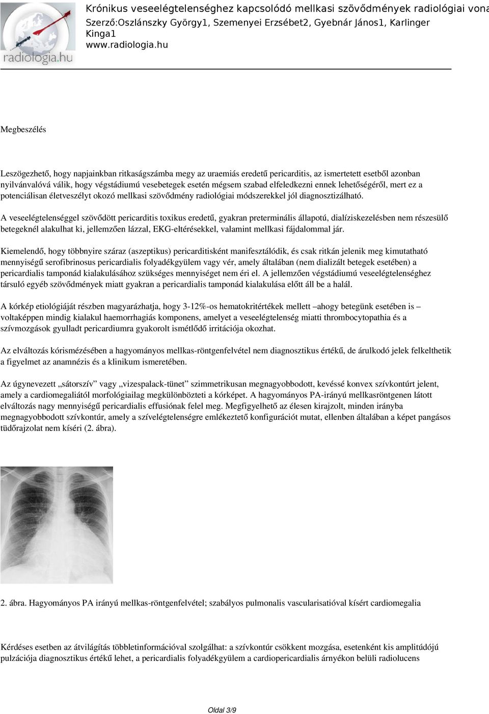 A veseelégtelenséggel szövődött pericarditis toxikus eredetű, gyakran preterminális állapotú, dialíziskezelésben nem részesülő betegeknél alakulhat ki, jellemzően lázzal, EKG-eltérésekkel, valamint