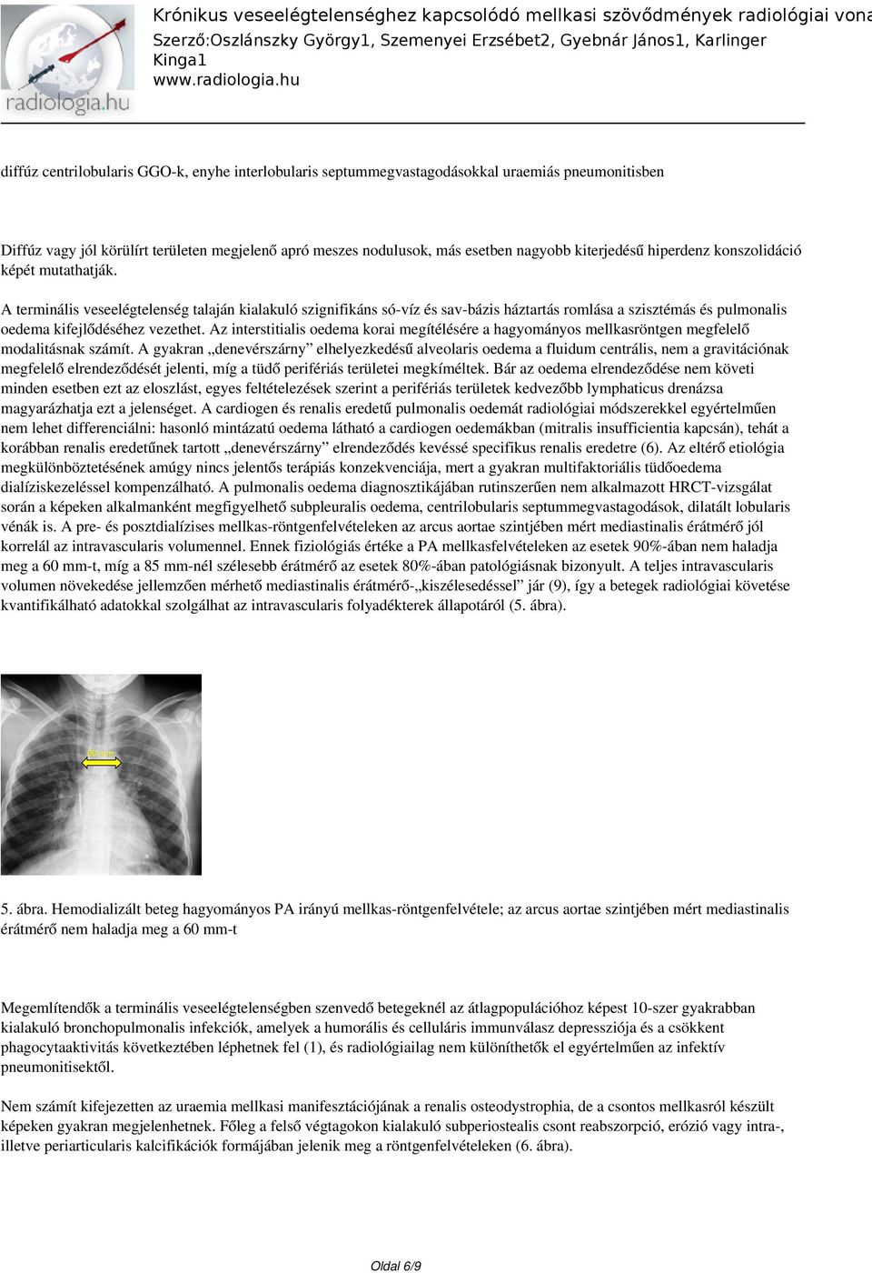 Az interstitialis oedema korai megítélésére a hagyományos mellkasröntgen megfelelő modalitásnak számít.