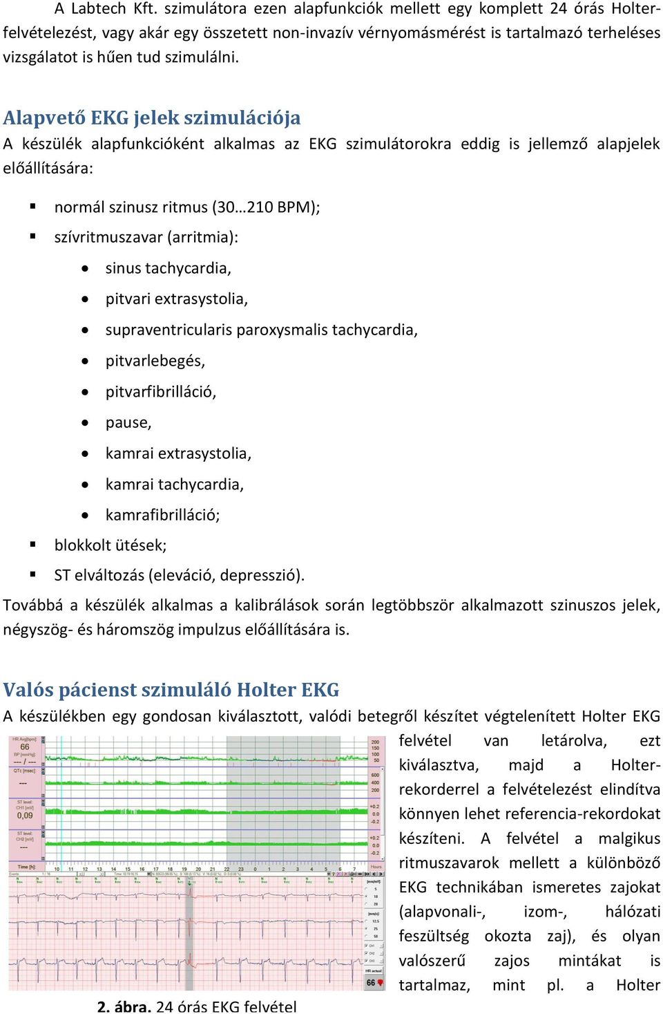 Alapvető EKG jelek szimulációja A készülék alapfunkcióként alkalmas az EKG szimulátorokra eddig is jellemző alapjelek előállítására: normál szinusz ritmus (30 210 BPM); szívritmuszavar (arritmia):