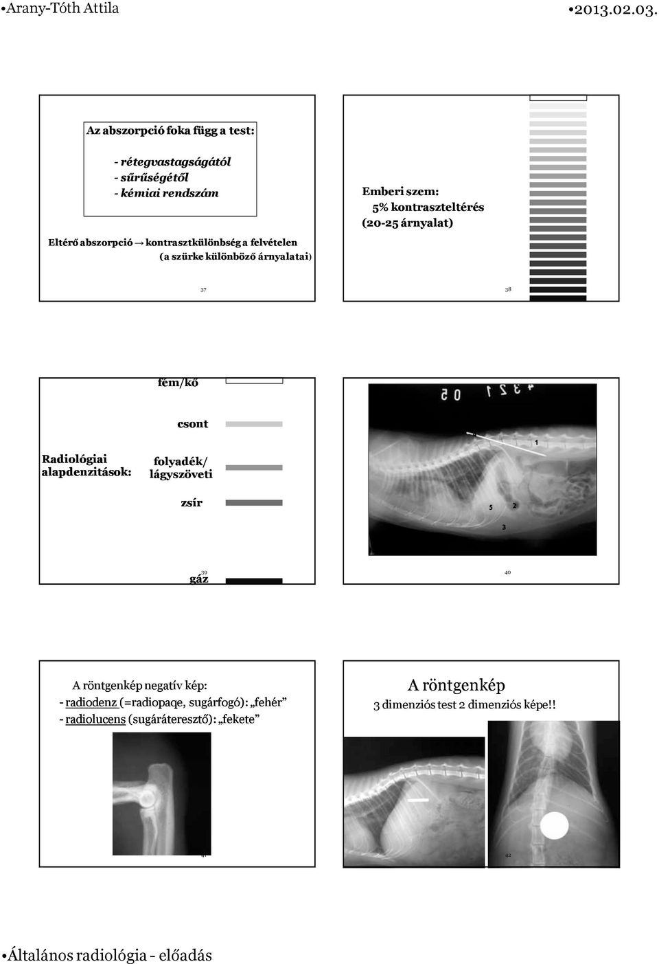 alapdenzitások: csont folyadék/ lágyszöveti 4 1 zsír 5 3 2 39 40 gáz A röntgenkép negatív kép: -radiodenz radiodenz(=