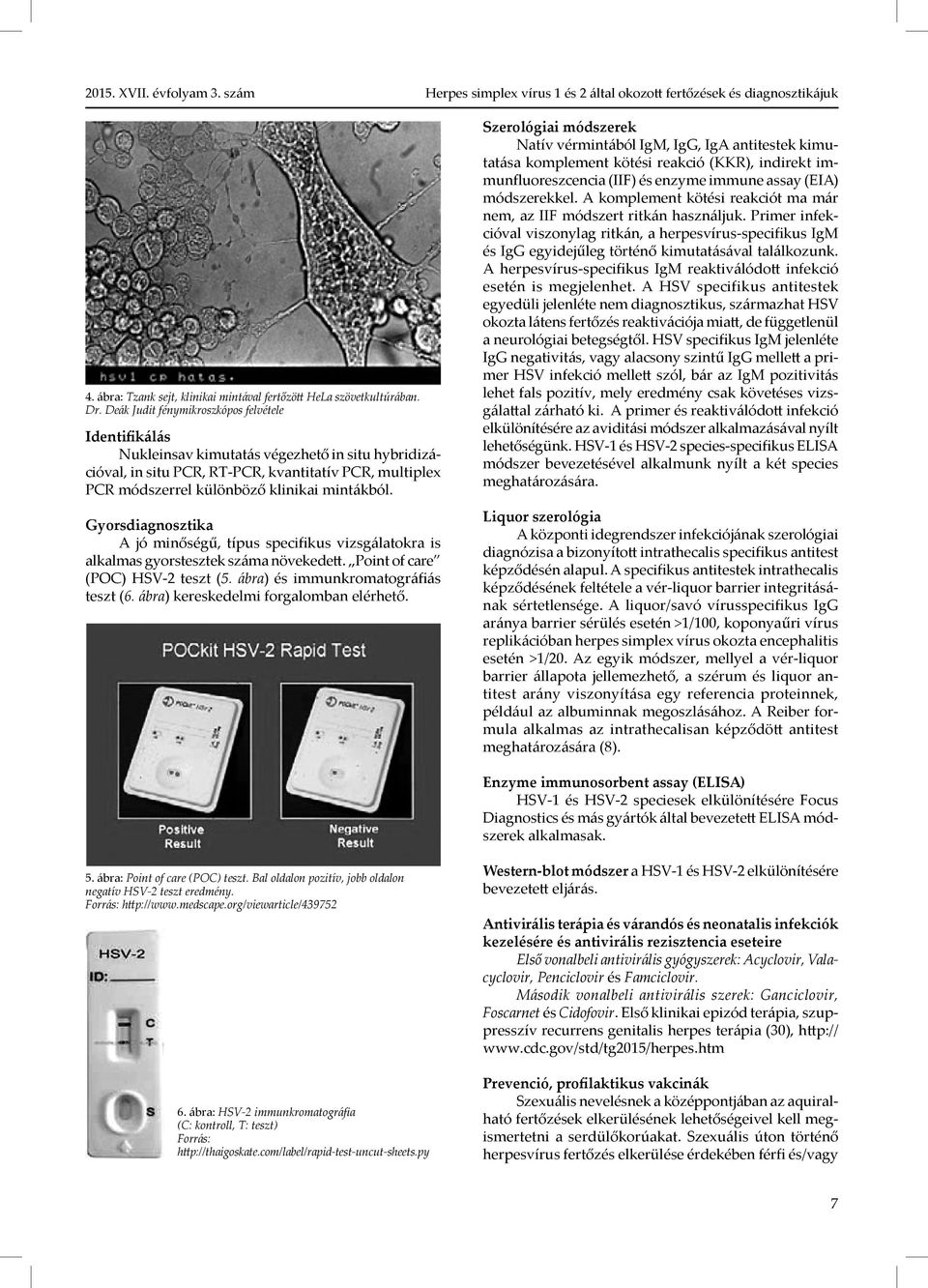 Gyorsdiagnosztika A jó minőségű, típus specifikus vizsgálatokra is alkalmas gyorstesztek száma növekedett. Point of care (POC) HSV-2 teszt (5. ábra) és immunkromatográfiás teszt (6.