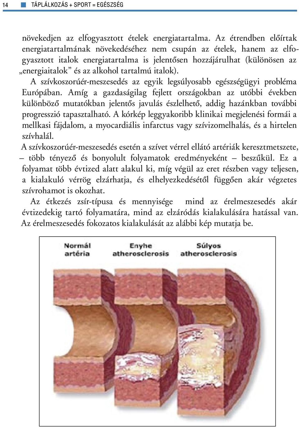 tartalmú italok). A szívkoszorúér-meszesedés az egyik legsúlyosabb egészségügyi probléma Európában.