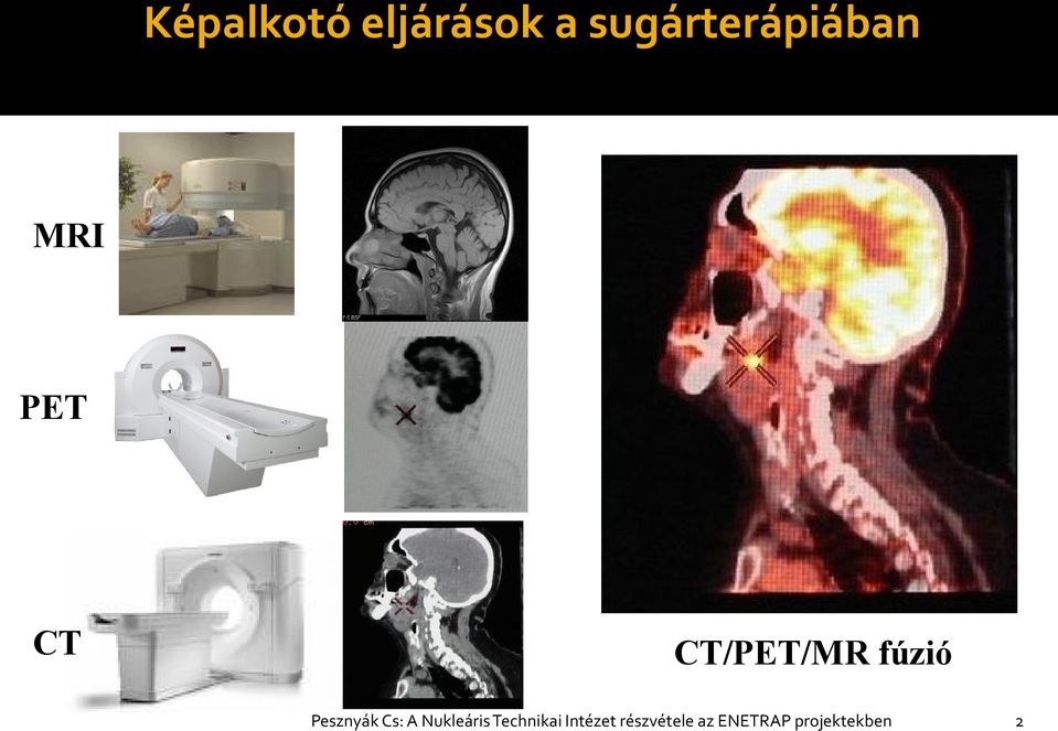 CT/PET/MR fúzió Pesznyák Cs: A