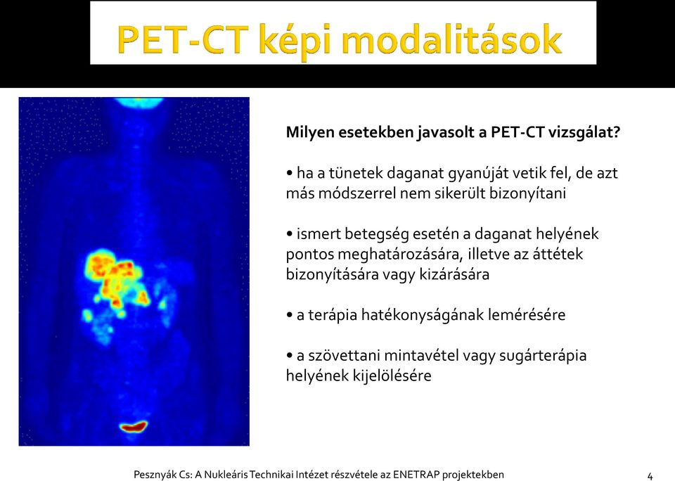 esetén a daganat helyének pontos meghatározására, illetve az áttétek bizonyítására vagy kizárására a