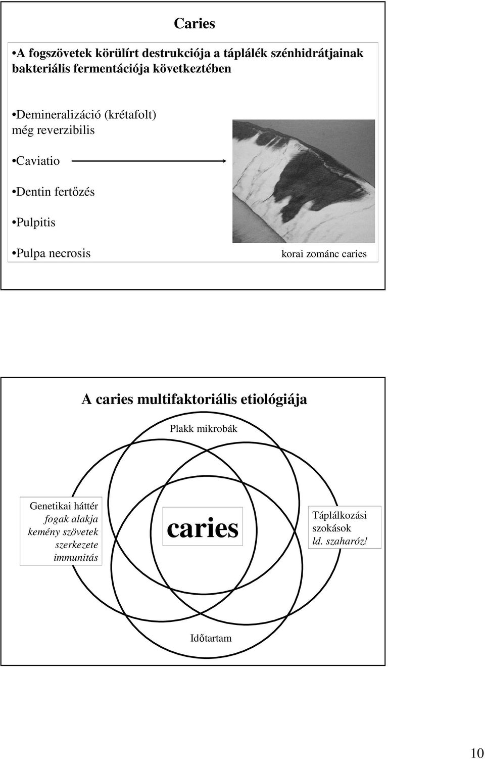 necrosis korai zománc caries A caries multifaktoriális etiológiája Plakk mikrobák Genetikai háttér