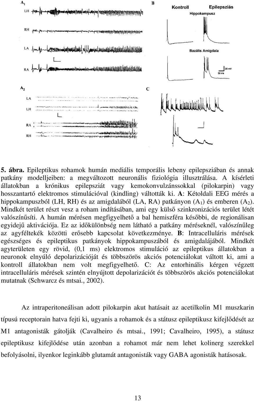 A: Kétoldali EEG mérés a hippokampuszból (LH, RH) és az amigdalából (LA, RA) patkányon (A 1 ) és emberen (A 2 ).