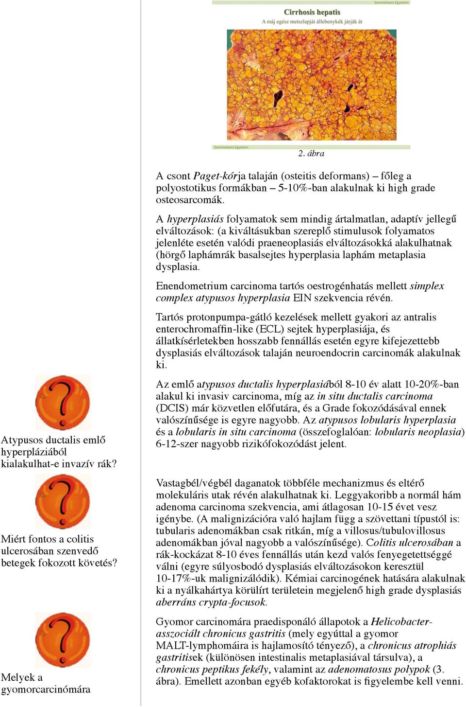 (hörgő laphámrák basalsejtes hyperplasia laphám metaplasia dysplasia. Enendometrium carcinoma tartós oestrogénhatás mellett simplex complex atypusos hyperplasia EIN szekvencia révén.