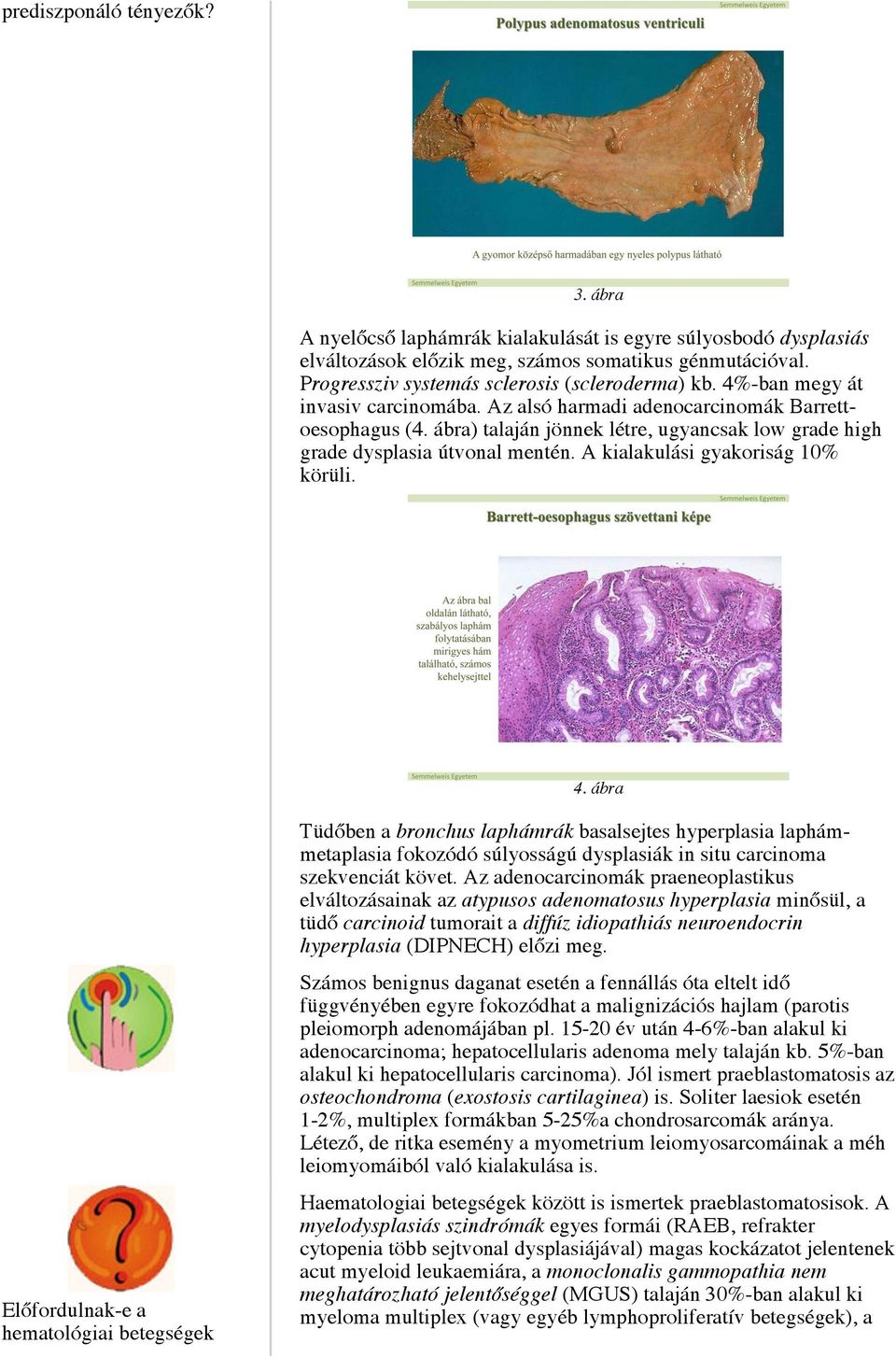 ábra) talaján jönnek létre, ugyancsak low grade high grade dysplasia útvonal mentén. A kialakulási gyakoriság 10% körüli. 4.