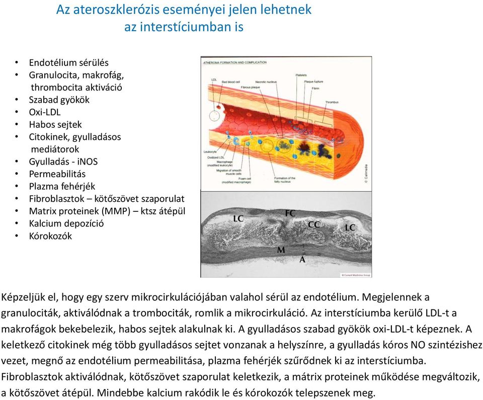 valahol sérül az endotélium. Megjelennek a granulociták, aktiválódnak a trombociták, romlik a mikrocirkuláció. Az interstíciumba kerülő LDL-t a makrofágok bekebelezik, habos sejtek alakulnak ki.