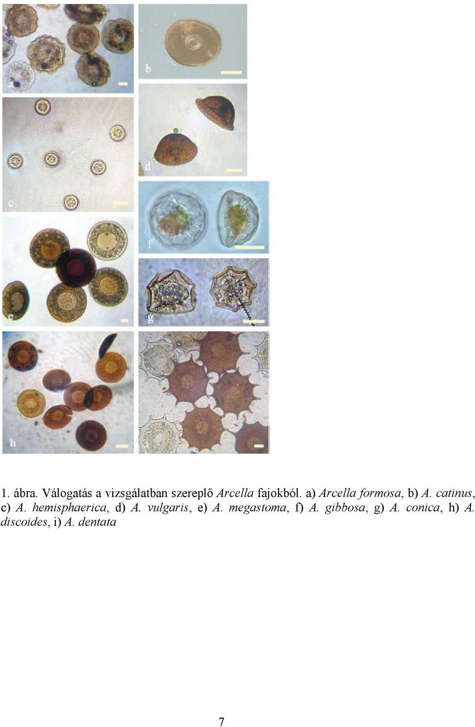 a) Arcella formosa, b) A. catinus, c) A.