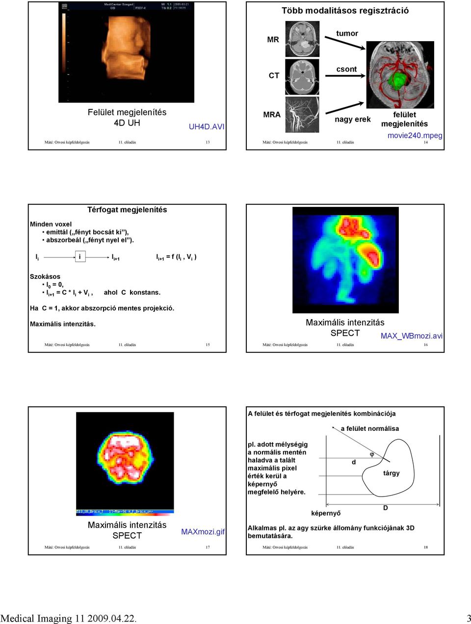 Ha C = 1, akkor abszorpció mentes projekció. Maximális intenzitás. Máté: Orvosi képfeldolgozás 11. előadás 15 Maximális intenzitás MAX_WBmozi.avi Máté: Orvosi képfeldolgozás 11.