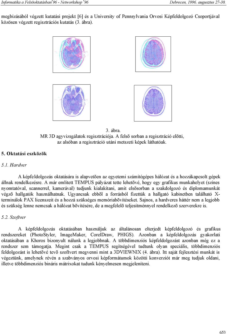 A képfeldolgozás oktatására is alapvetõen az egyetemi számítógépes hálózat és a hozzákapcsolt gépek állnak rendelkezésre.