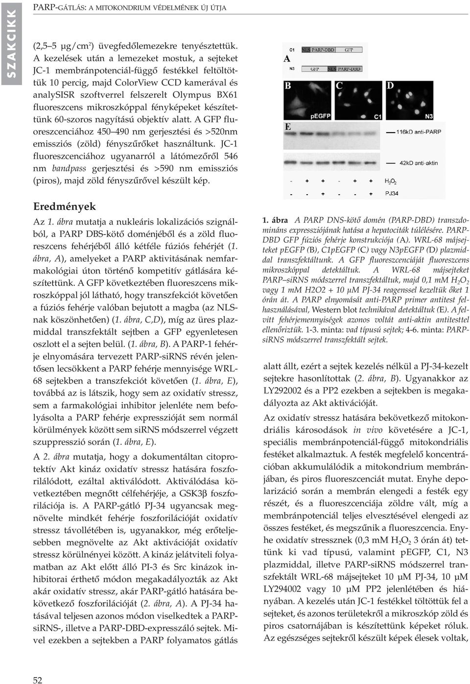 mikroszkóppal fényképeket készítettünk 60-szoros nagyítású objektív alatt. A GFP fluoreszcenciához 450 490 nm gerjesztési és >520nm emissziós (zöld) fényszûrôket használtunk.