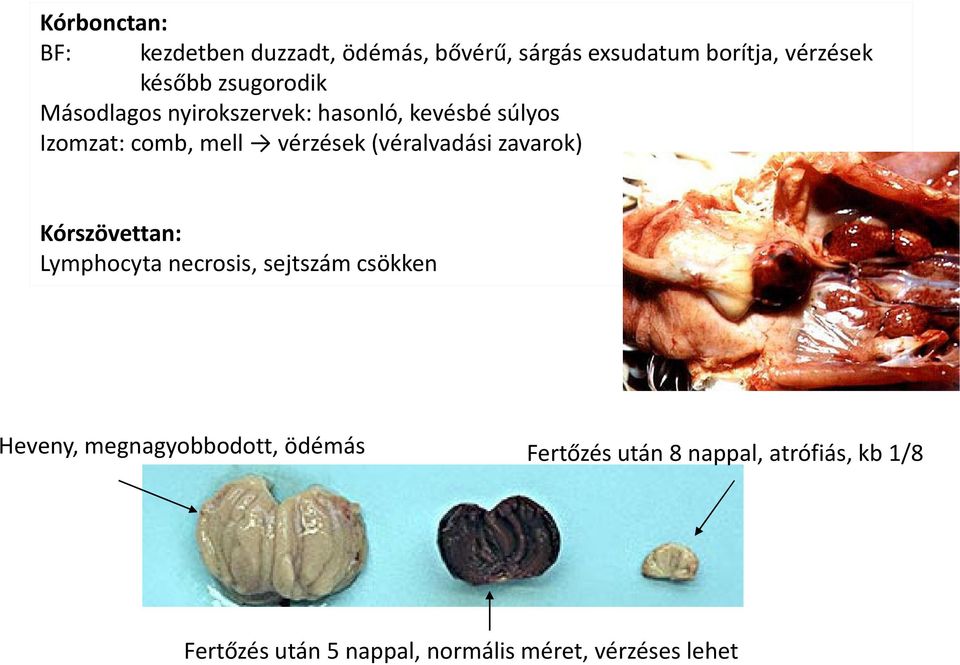 (véralvadási zavarok) Kórszövettan: Lymphocyta necrosis, sejtszám csökken Heveny,