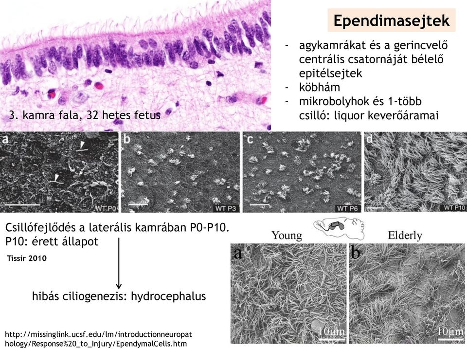 laterális kamrában P0-P10. P10: érett állapot Tissir 2010 Gerincvelő, hibás ciliogenezis: hydrocephalus központi csatorna http://missinglink.ucsf.