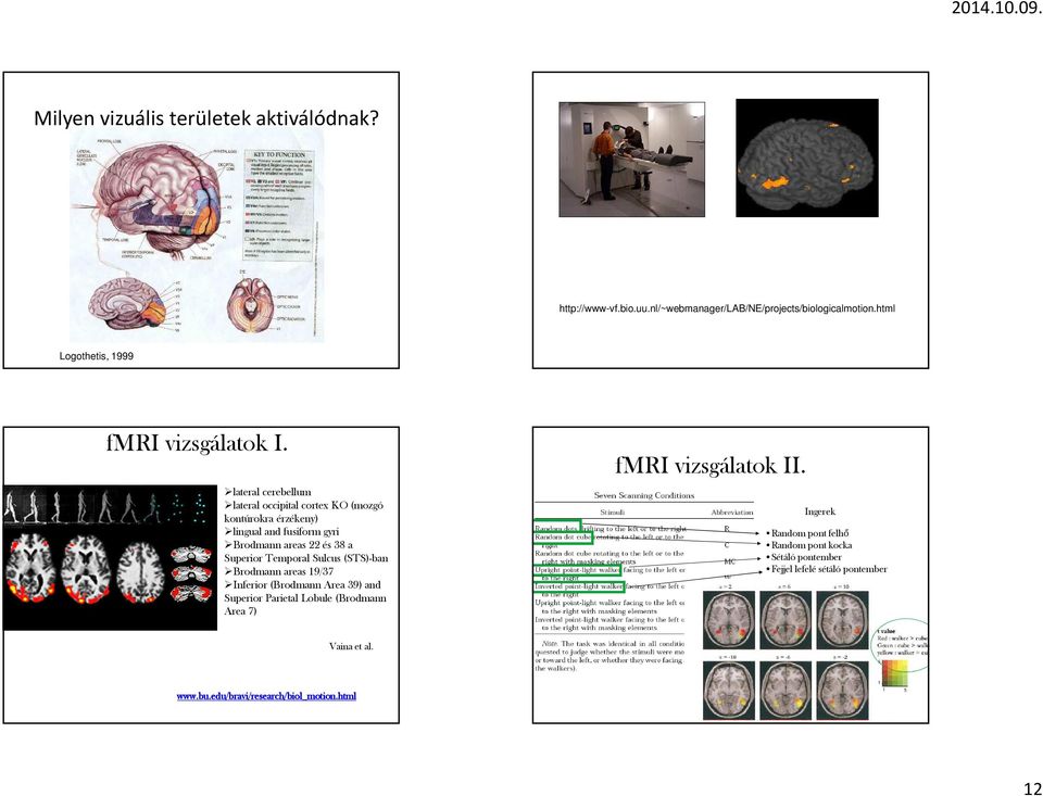 (STS)-ban Brodmann areas 19/37 Inferior (Brodmann Area 39) and Superior Parietal Lobule (Brodmann Area 7) fmri vizsgálatok II.