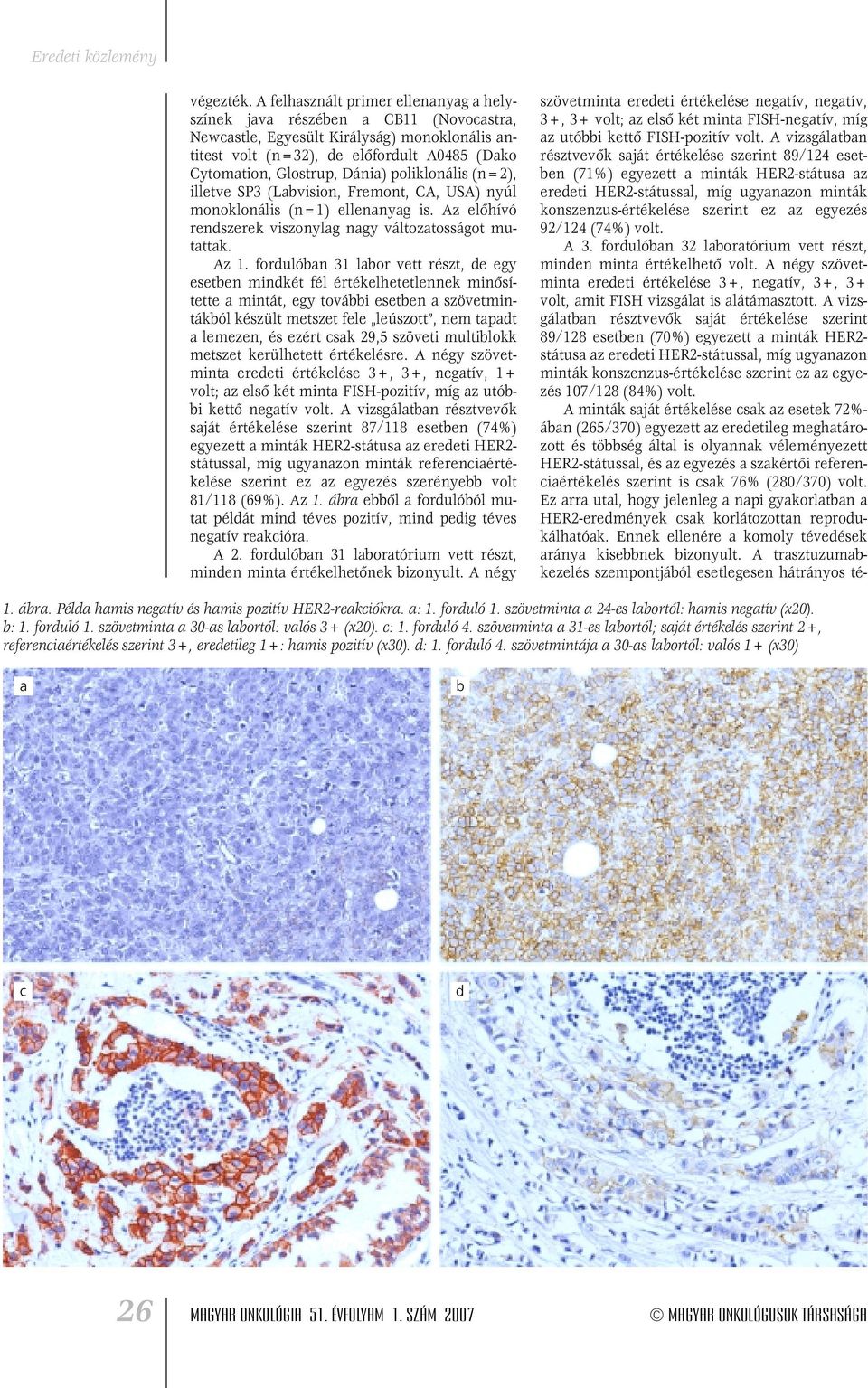 poliklonális (n=2), illetve SP3 (Labvision, Fremont, CA, USA) nyúl monoklonális (n=1) ellenanyag is. Az elôhívó rendszerek viszonylag nagy változatosságot mutattak. Az 1.