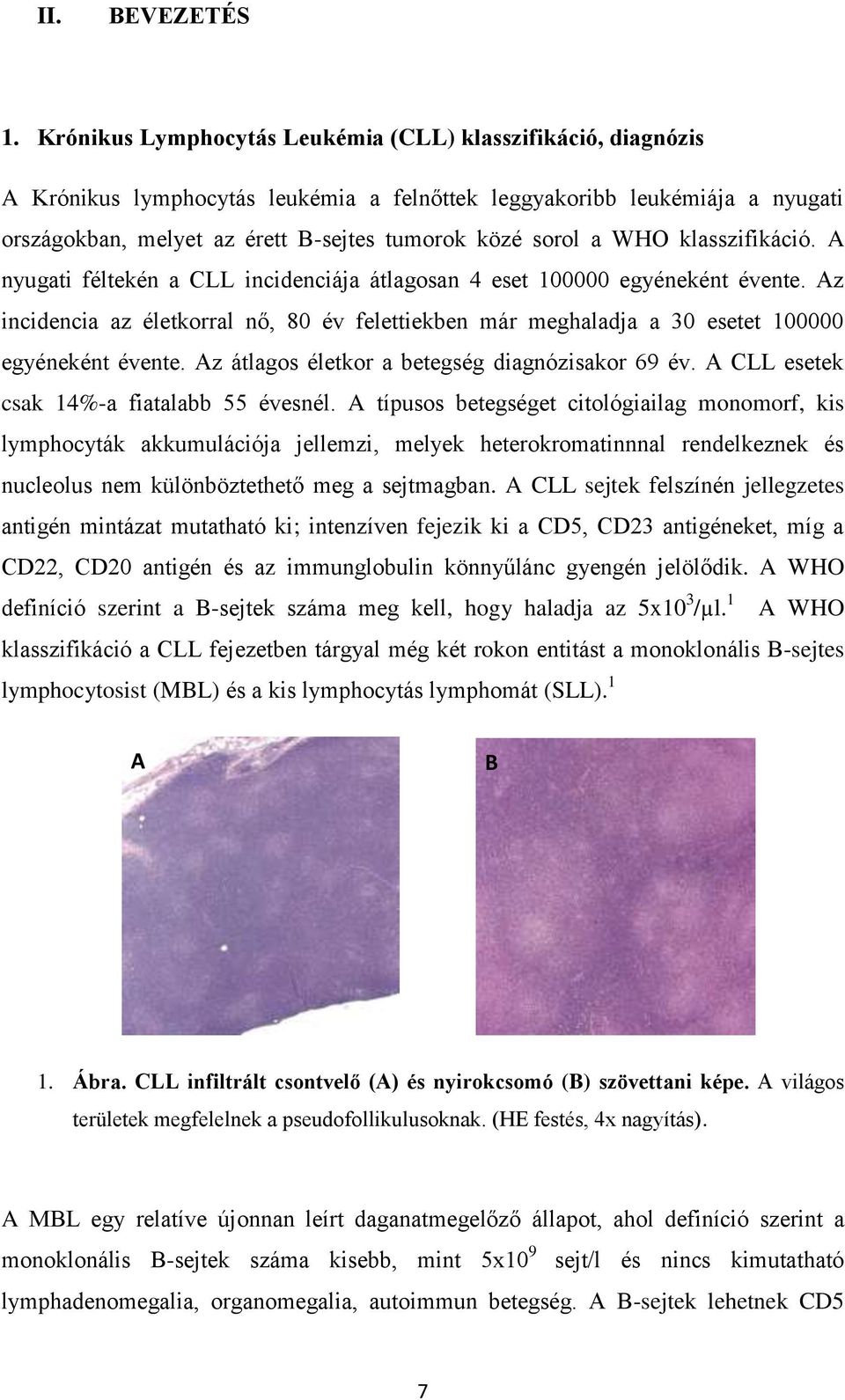 WHO klasszifikáció. A nyugati féltekén a CLL incidenciája átlagosan 4 eset 100000 egyéneként évente.