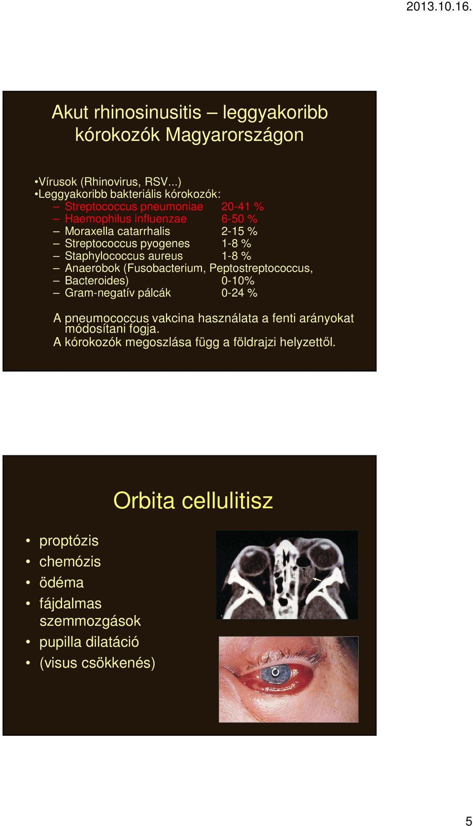 pyogenes 1-8 % Staphylococcus aureus 1-8 % Anaerobok (Fusobacterium, Peptostreptococcus, Bacteroides) 0-10% Gram-negatív pálcák 0-24 % A