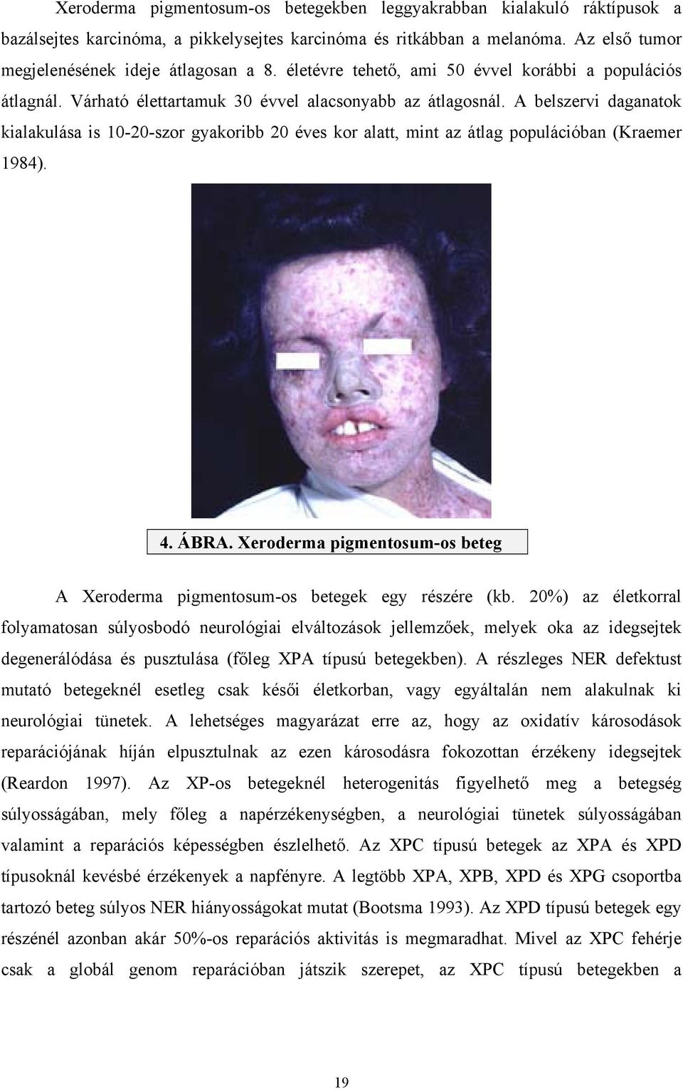 A belszervi daganatok kialakulása is 10-20-szor gyakoribb 20 éves kor alatt, mint az átlag populációban (Kraemer 1984). 4. ÁBRA.