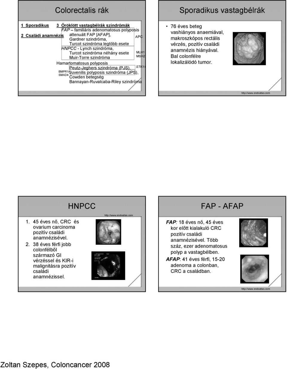 Cowden betegség Bannayan-Ruvalcaba-Riley szindróma Sporadikus vastagbélrák 76 éves beteg vashiányos anaemiával, makroszkópos rectális vérzés, pozitív családi anamnézis hiányával.