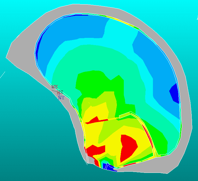 Brain Trauma Model