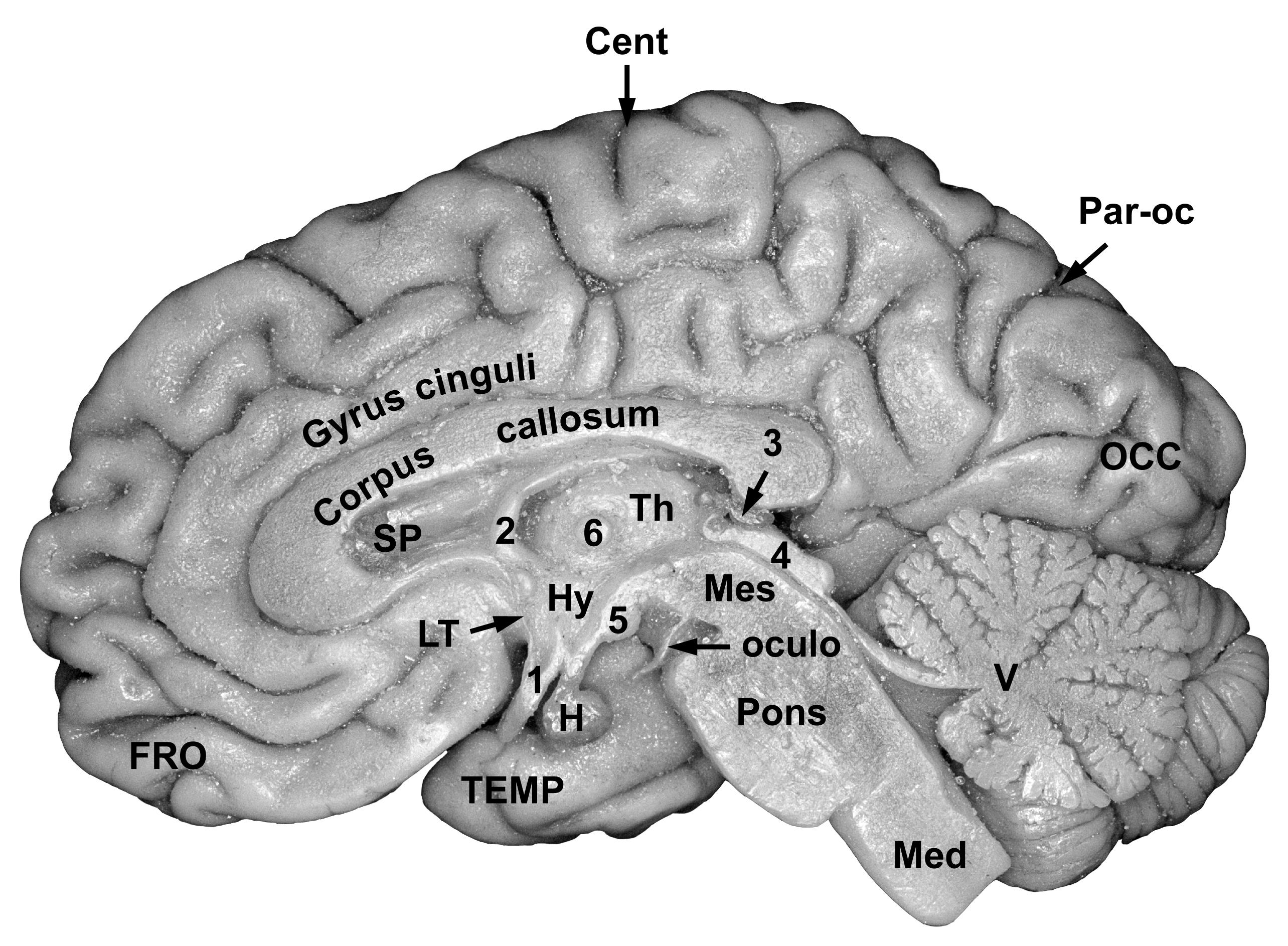 A CEREBELLUM HELYZETE Cisterna