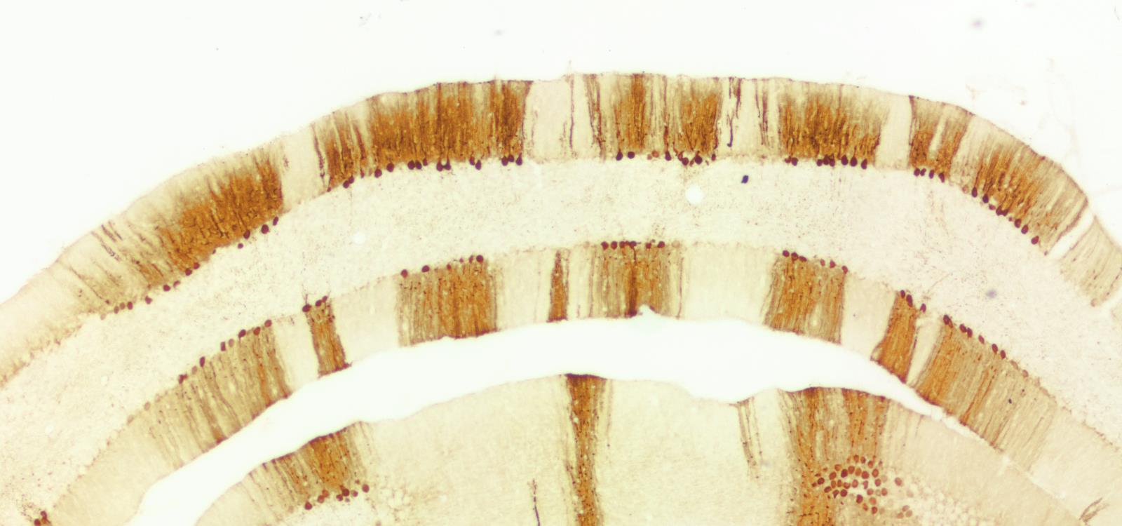 m gr Patkány cerebellum cortex aldolase C immunhisztokémiai kimutatása (4x). Látható, hogy a Purkinje-sejtek (nyilak) festődő csoportjai csíkokra osztják a kisagykérget.