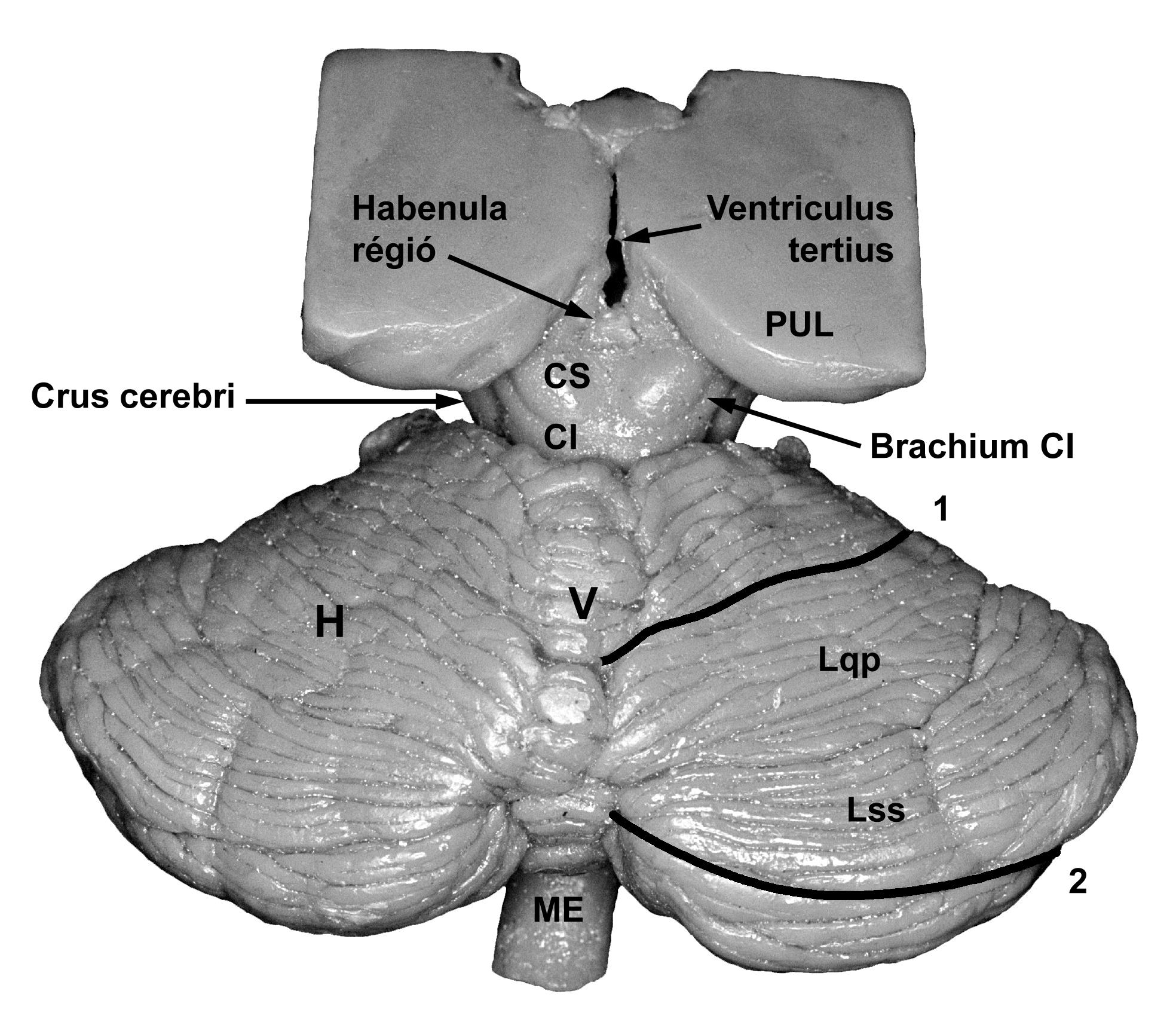 A KISAGY DORSALIS FELSZÍNE ME: nyúltvelő CS: colliculus superior CI: colliculus inferior V: vermis H: hemispherium