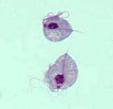 Trichomonas vaginalis A leggyakoribb