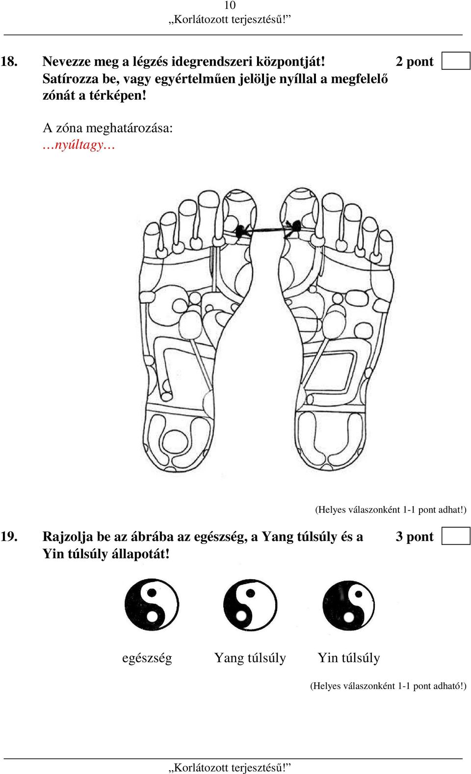 térképen! A zóna meghatározása: nyúltagy (Helyes válaszonként 1-1 pont adhat!) 19.
