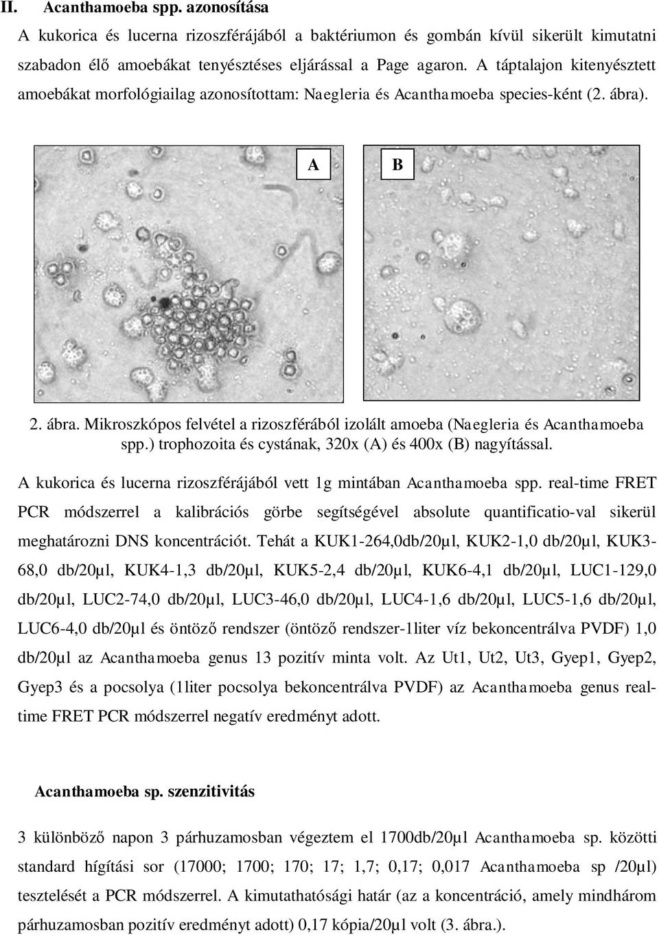 ) trophozoita és cystának, 320x (A) és 400x (B) nagyítással. A kukorica és lucerna rizoszférájából vett 1g mintában Acanthamoeba spp.