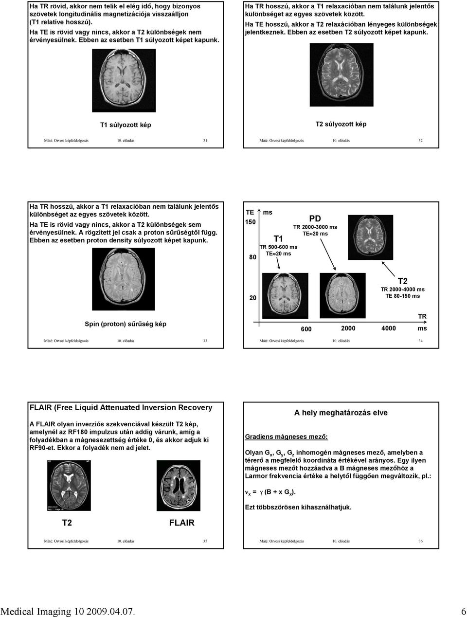 Ha TE hosszú, akkor a T2 relaxációban lényeges különbségek jelentkeznek. Ebben az esetben T2 súlyozott képet kapunk. T1 súlyozott kép T2 súlyozott kép Máté: Orvosi képfeldolgozás 10.