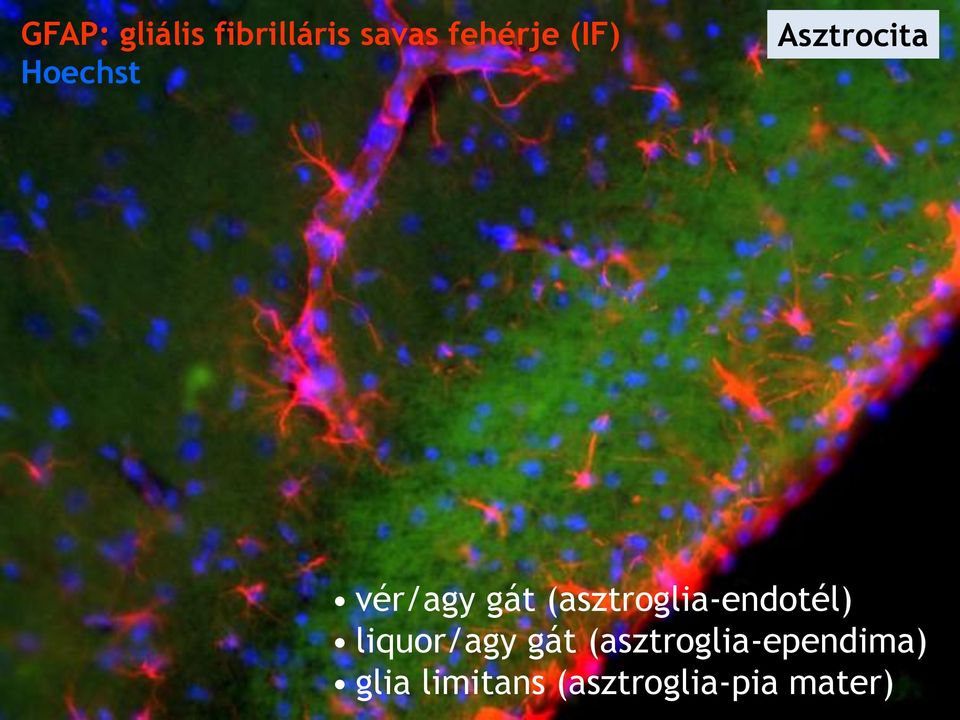 (asztroglia-endotél) liquor/agy gát