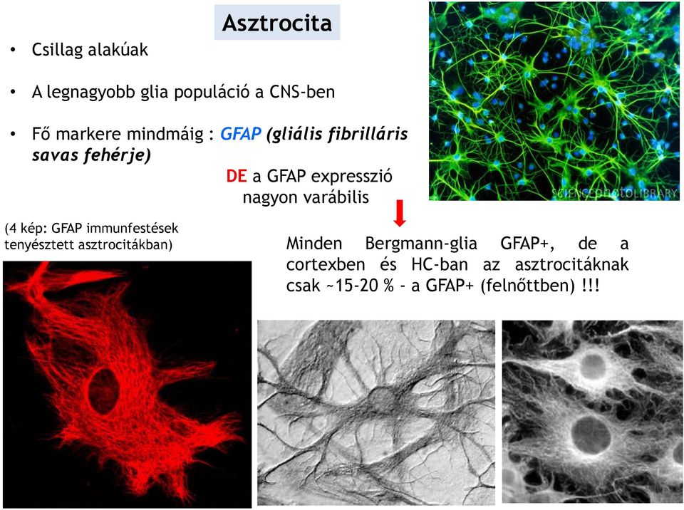 varábilis (4 kép: GFAP immunfestések tenyésztett asztrocitákban) Minden