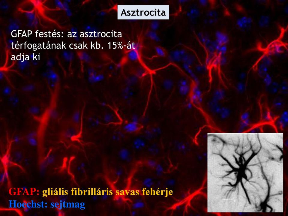 15%-át adja ki Asztrocita GFAP: