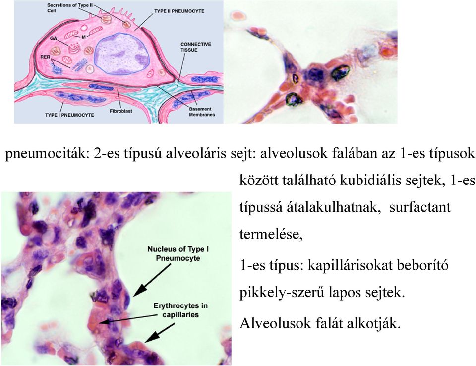 átalakulhatnak, surfactant termelése, 1-es típus: