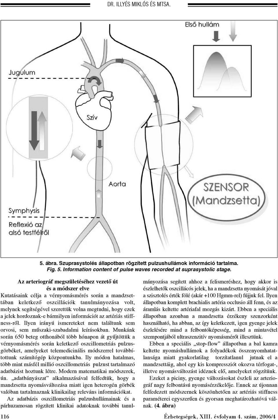 megtudni, hogy ezek a jelek hordoznak-e bármilyen információt az artériás stiffness-rõl. Ilyen irányú ismereteket nem találtunk sem orvosi, sem mûszaki-szabadalmi leírásokban.