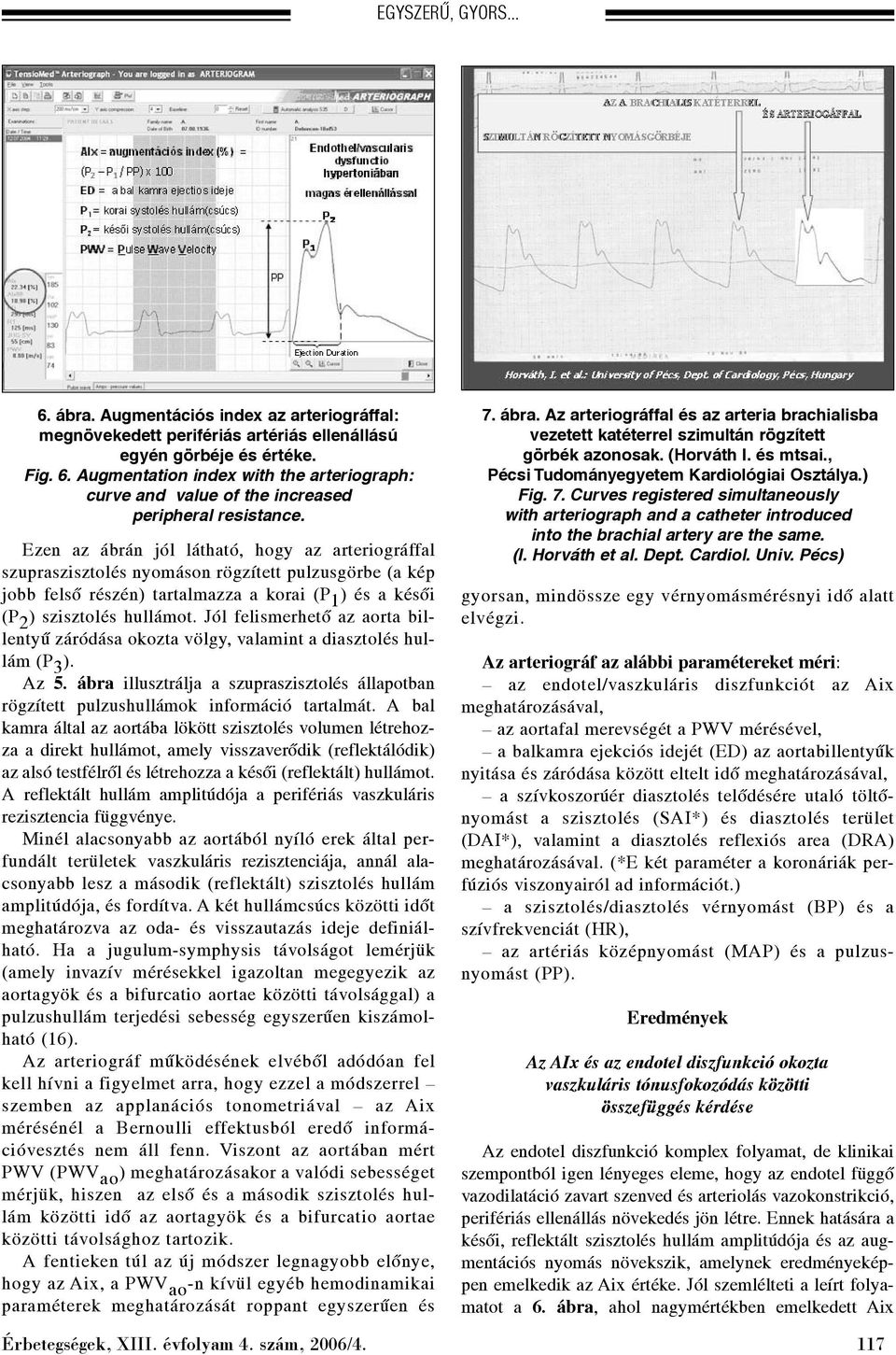 Jól felismerhetõ az aorta billentyû záródása okozta völgy, valamint a diasztolés hullám (P 3 ). Az 5. ábra illusztrálja a szupraszisztolés állapotban rögzített pulzushullámok információ tartalmát.